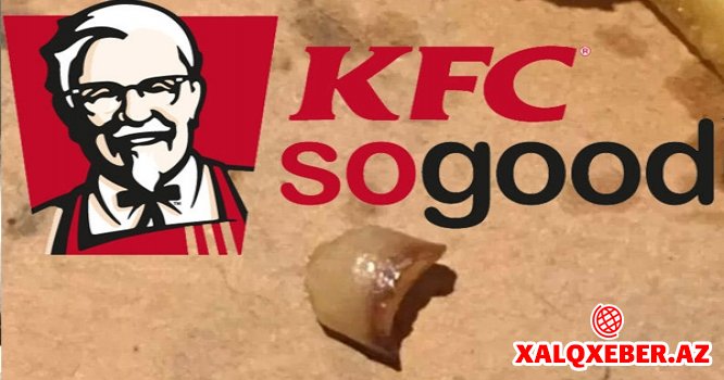 "KFC"də çipsin içindən elə şey çıxdı ki... - FOTOLAR
