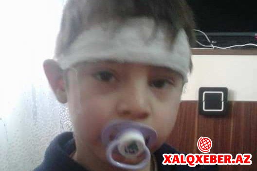 Bakıda uşağı atasının sevgilisi ölümcül döydü - FOTO