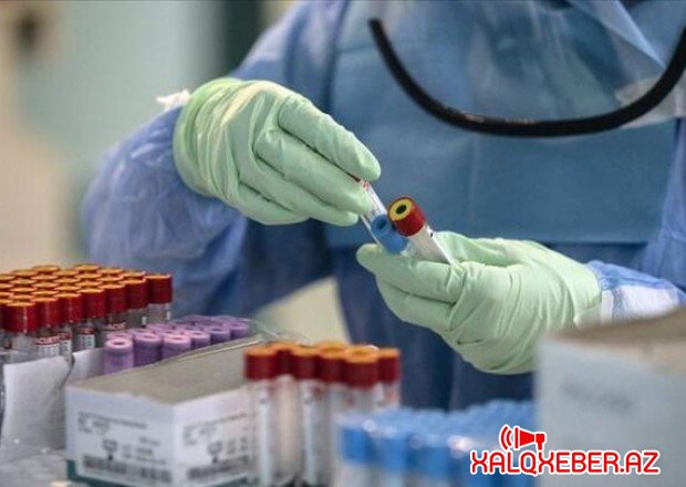 Azərbaycanda koronavirusa yoluxanların sayı 700-ü ötdü - 7 nəfər öldü