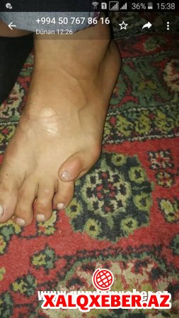 Arzu Rəhimovun “bermud üçbucağı” hesabına sildirdiyi milyonlar – FOTOLAR