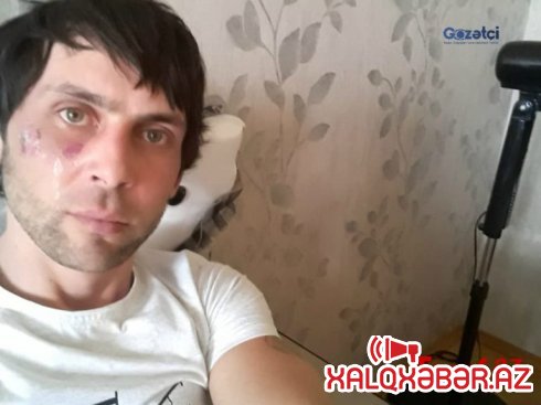 ”Polis şöbəsində məni ”qril” formasına salıb işgəncə verdilər”