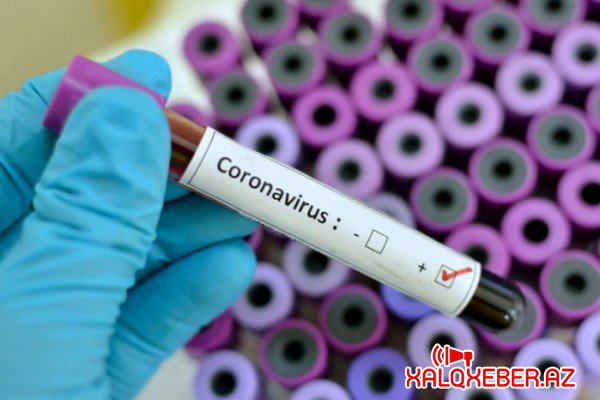 Ölkədə koronavirusa yoluxanların sayı 991-ə çatdı