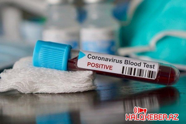 Azərbaycanda 49 nəfər koronavirusa yoluxdu - 1-i ÖLDÜ