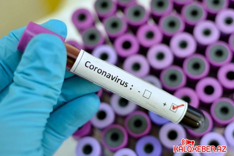 Bu tarixdə koronavirus yoxa çıxacaq - ŞAD XƏBƏR