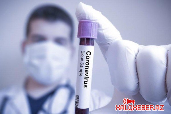 Azərbaycanda daha 39 nəfər koronavirusa yoluxdu