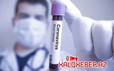 Azərbaycanda daha 65 nəfər koronavirusa yoluxdu - 2 nəfər vəfat etdi