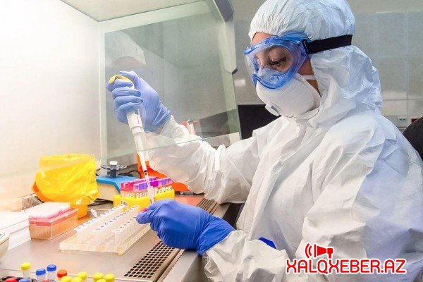 Azərbaycanda daha 572 nəfər koronavirusa yoluxdu - 8 nəfər öldü