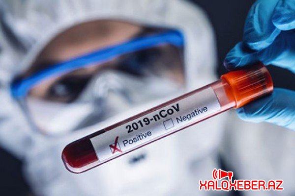 Azərbaycanda koronavirusa yoluxma sayı 79-a düşdü - 2 nəfər öldü