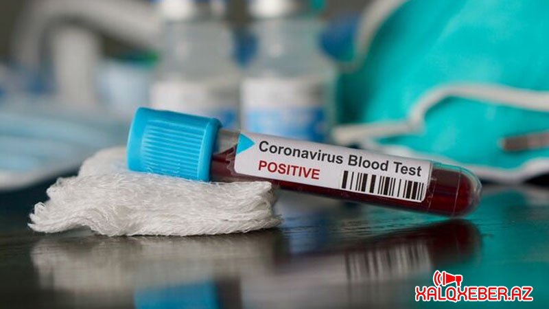 Koronavirusa yoluxanların sayı açıqlandı - GÜNÜN STATİSTİKASI