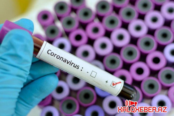 Azərbaycanda gündəlik koronavirusa yoluxma sayı azaldı - Ölənlər var