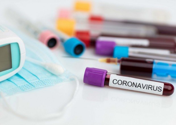 Azərbaycanda daha 472 nəfərdə koronavirus aşkarlandı - 11 nəfər öldü