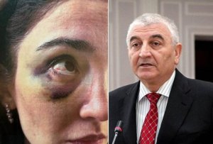 DƏHŞƏT!!! Zənginlər də ağlayır: Məzahir Pənahovun oğlu Məhəmməd arvadını az qala öldürəcəkdi FOTO