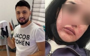 Əmrah Mehdiyev pis günə qoyduğu pasientini məhkəmə ilə hədələyir... - TƏFƏRRÜAT
