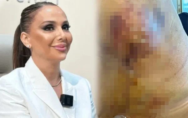 Könül Ağamirova 3 dəfə əməliyyat edib məni pis vəziyyətə qoydu