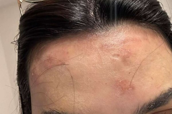 "Vecimə də deyil" - Müştərinin alnı yanan salonun rəhbəri - FOTO